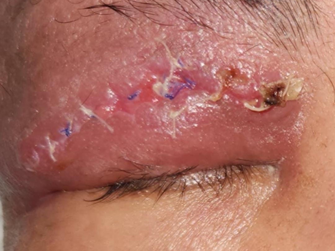 Sensitive Content